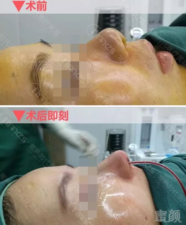 https://img.miyanlife.com/mnt/timg/180704/11452TP1-7.jpg