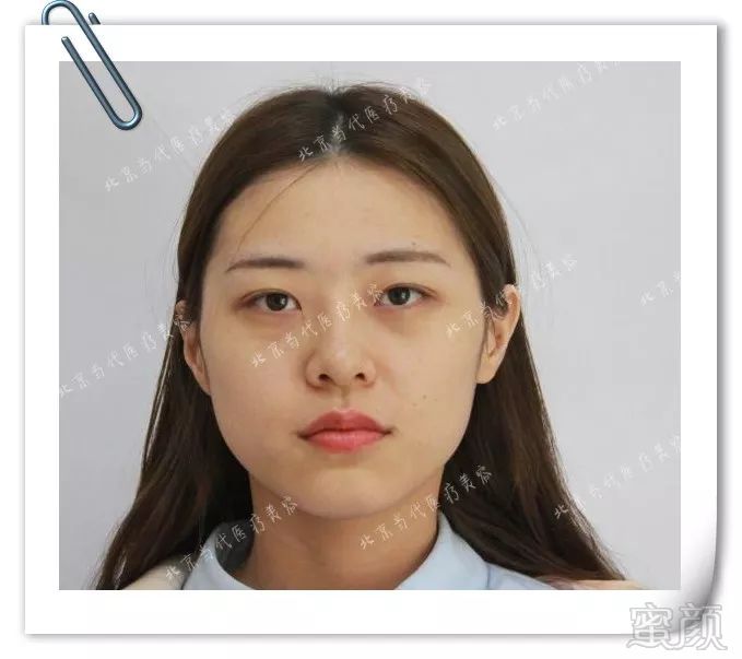 https://img.miyanlife.com/mnt/timg/180704/1154342517-1.jpg