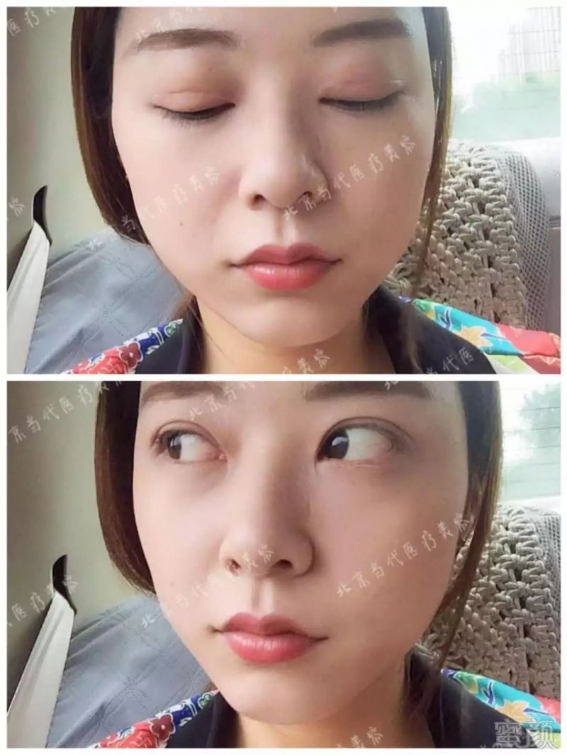 https://img.miyanlife.com/mnt/timg/180704/11543GJ8-11.jpg