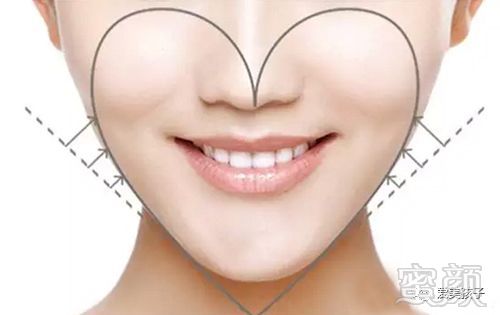 https://img.miyanlife.com/mnt/timg/180704/115A1O17-0.jpg