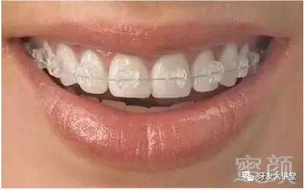 https://img.miyanlife.com/mnt/timg/180704/115T93121-11.jpg