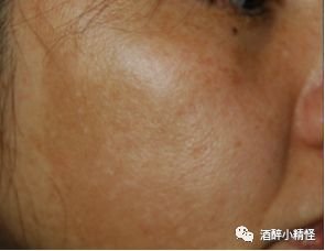 https://img.miyanlife.com/mnt/timg/180704/115U43351-4.jpg