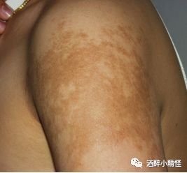 https://img.miyanlife.com/mnt/timg/180704/115U55E3-7.jpg