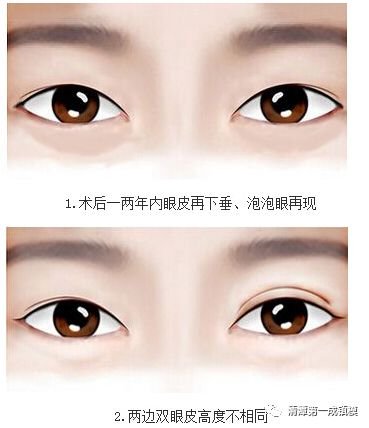 https://img.miyanlife.com/mnt/timg/180704/12024BN3-1.jpg