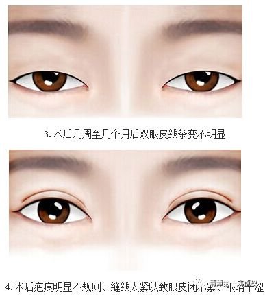 https://img.miyanlife.com/mnt/timg/180704/12024K5J-2.jpg