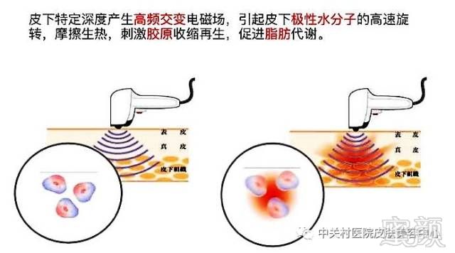 https://img.miyanlife.com/mnt/timg/180704/121434M01-1.jpg