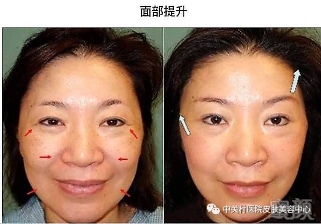https://img.miyanlife.com/mnt/timg/180704/12143K296-6.jpg
