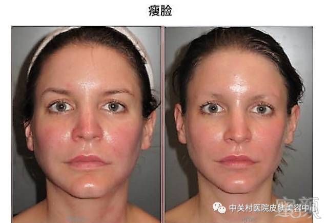 https://img.miyanlife.com/mnt/timg/180704/12143L622-5.jpg