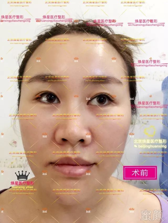 https://img.miyanlife.com/mnt/timg/180704/12234R314-4.jpg