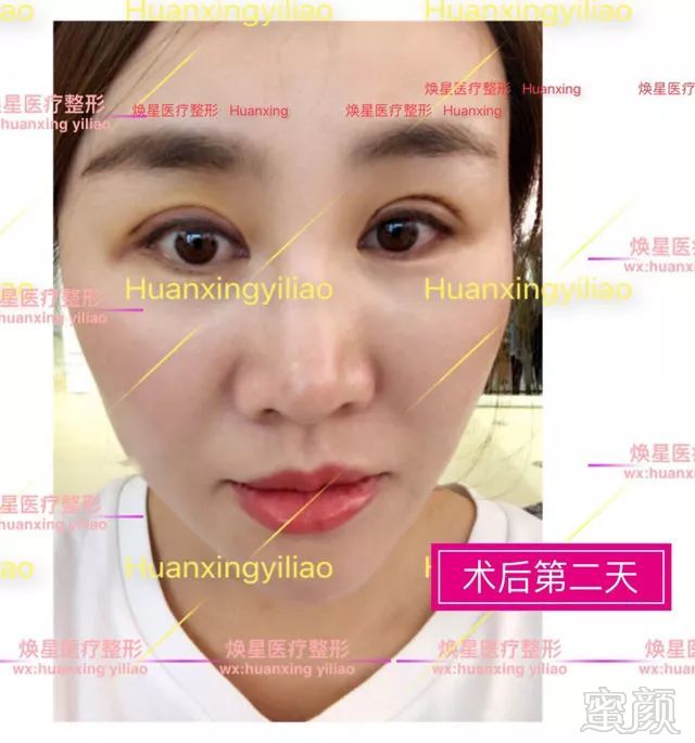 https://img.miyanlife.com/mnt/timg/180704/1223514236-6.jpg