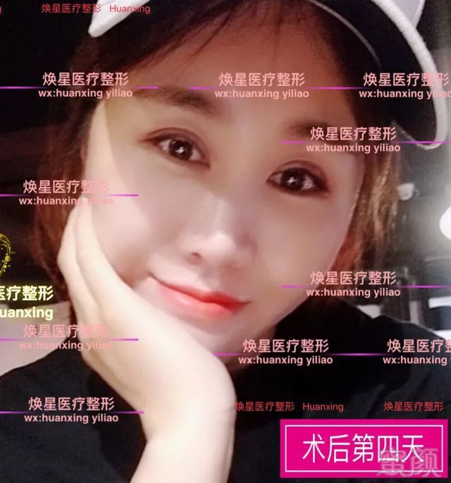 https://img.miyanlife.com/mnt/timg/180704/12235K307-8.jpg