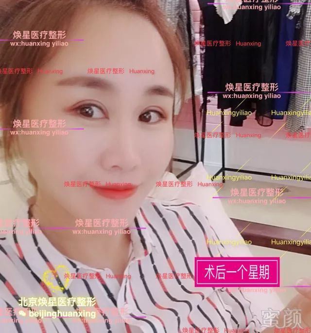 https://img.miyanlife.com/mnt/timg/180704/12235W0J-9.jpg