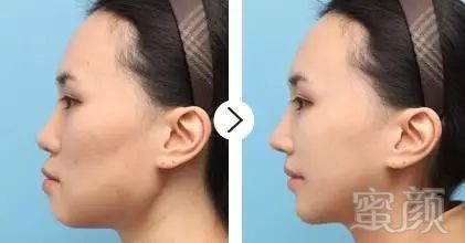 https://img.miyanlife.com/mnt/timg/180704/12320052a-5.jpg