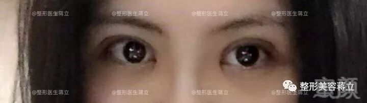 https://img.miyanlife.com/mnt/timg/180704/1301334024-1.jpg