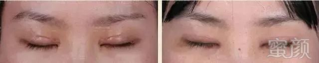 https://img.miyanlife.com/mnt/timg/180704/1314494326-2.jpg