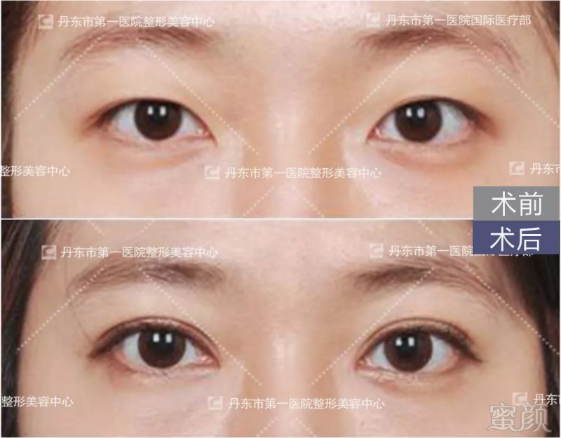 https://img.miyanlife.com/mnt/timg/180704/1314503M2-7.jpg