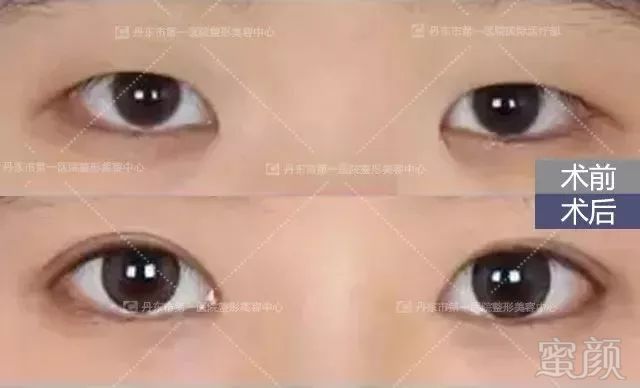 https://img.miyanlife.com/mnt/timg/180704/1314505135-8.jpg