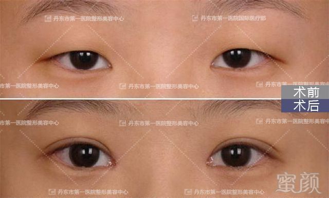 https://img.miyanlife.com/mnt/timg/180704/1314514960-9.jpg