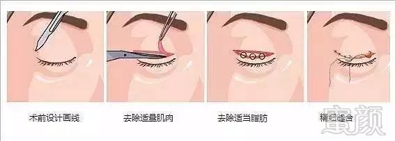 https://img.miyanlife.com/mnt/timg/180704/1421152D2-0.jpg