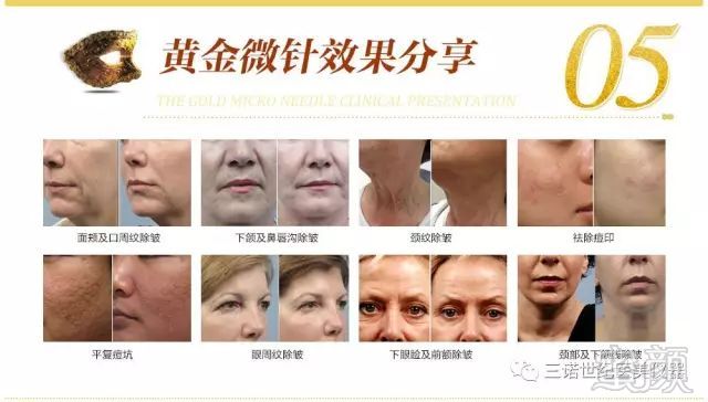 https://img.miyanlife.com/mnt/timg/180704/14562I027-12.jpg
