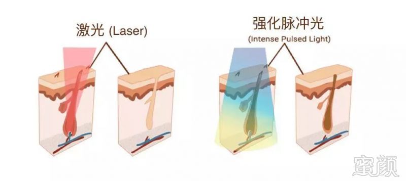 案例图片