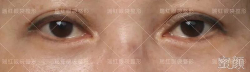 https://img.miyanlife.com/mnt/timg/180704/1519503014-1.jpg