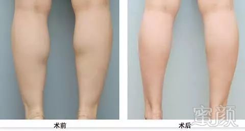 https://img.miyanlife.com/mnt/timg/180705/103ZaB7-5.jpg
