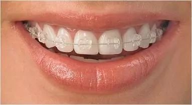 https://img.miyanlife.com/mnt/timg/180705/1050505256-7.jpg