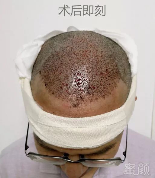 https://img.miyanlife.com/mnt/timg/180705/11093244F-1.jpg