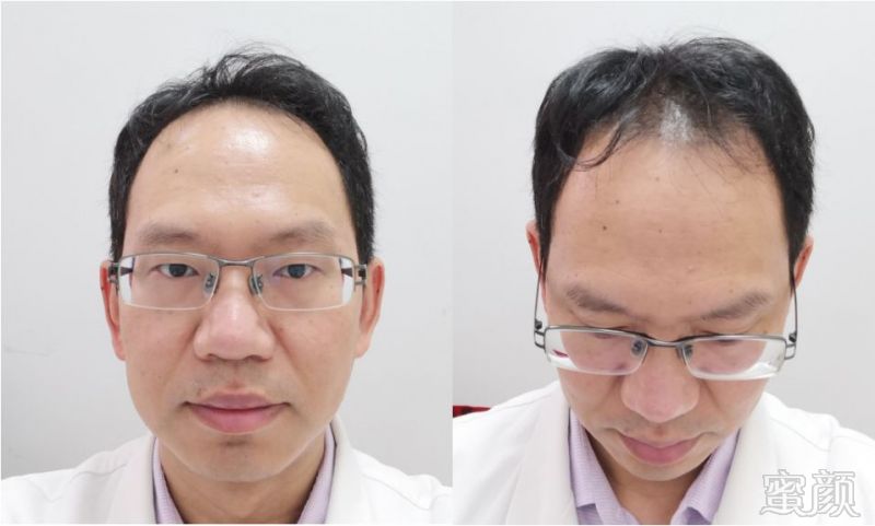 https://img.miyanlife.com/mnt/timg/180705/1109325438-0.jpg