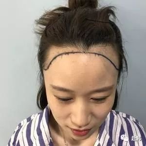 https://img.miyanlife.com/mnt/timg/180705/110P43964-0.jpg