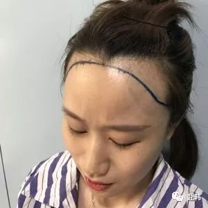 https://img.miyanlife.com/mnt/timg/180705/110P53259-1.jpg