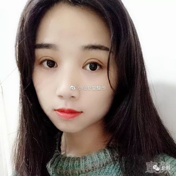 https://img.miyanlife.com/mnt/timg/180705/1114013L5-2.jpg