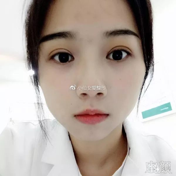 https://img.miyanlife.com/mnt/timg/180705/1114021194-6.jpg