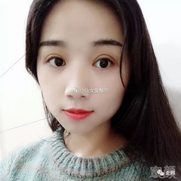 https://img.miyanlife.com/mnt/timg/180705/11140220S-3.jpg
