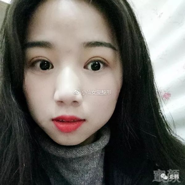 https://img.miyanlife.com/mnt/timg/180705/1114026258-5.jpg