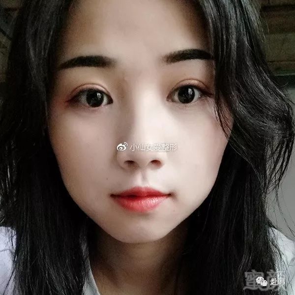 https://img.miyanlife.com/mnt/timg/180705/1114032338-9.jpg