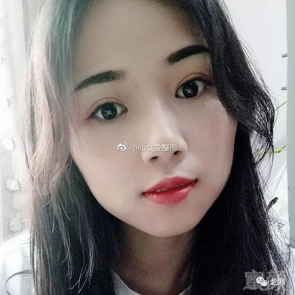 https://img.miyanlife.com/mnt/timg/180705/1114034Y2-8.jpg