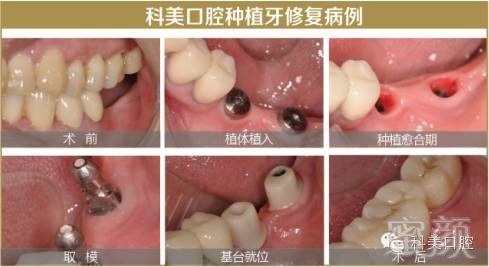 https://img.miyanlife.com/mnt/timg/180705/111920C06-6.jpg