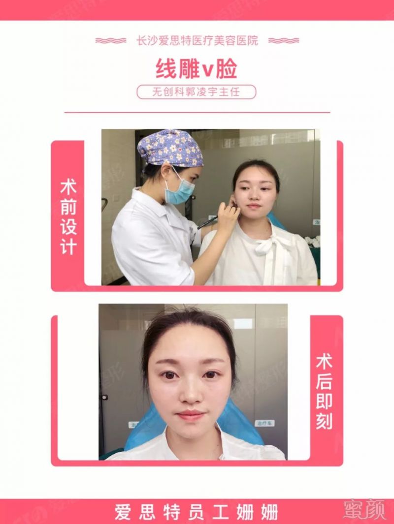 https://img.miyanlife.com/mnt/timg/180705/112555H33-4.jpg