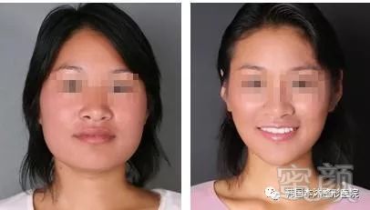 https://img.miyanlife.com/mnt/timg/180705/1129455J0-15.jpg