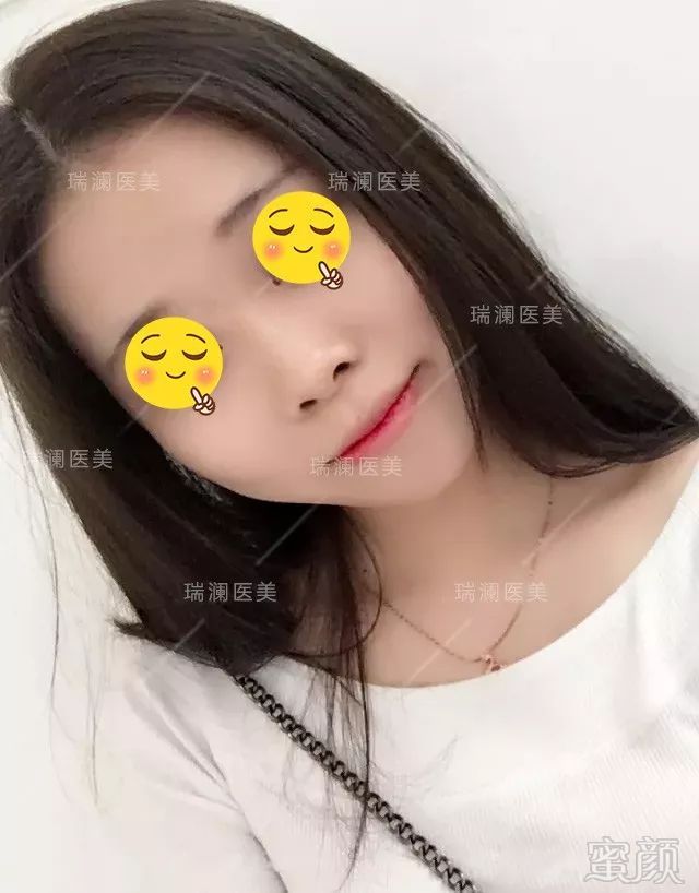 案例图片