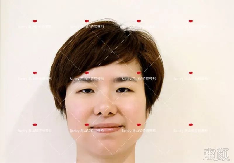 https://img.miyanlife.com/mnt/timg/180705/113U56093-1.jpg