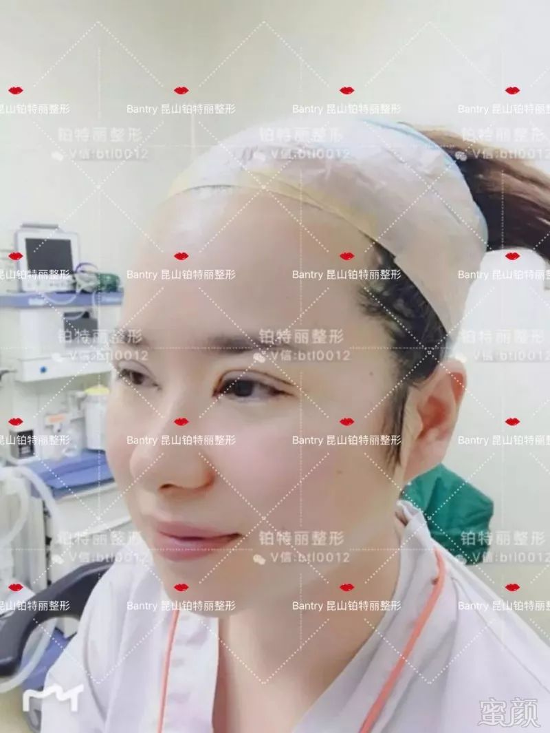 https://img.miyanlife.com/mnt/timg/180705/113U96232-9.jpg