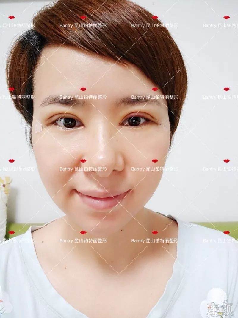 https://img.miyanlife.com/mnt/timg/180705/113Z510A-11.jpg