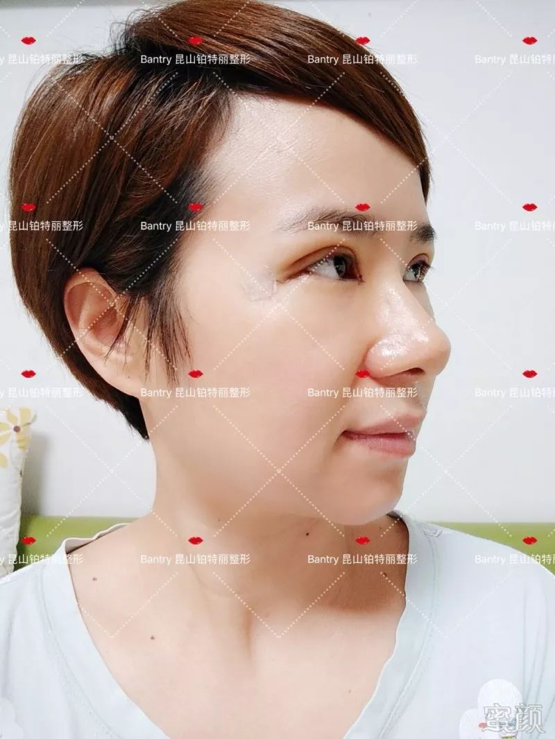 https://img.miyanlife.com/mnt/timg/180705/113Z62163-12.jpg