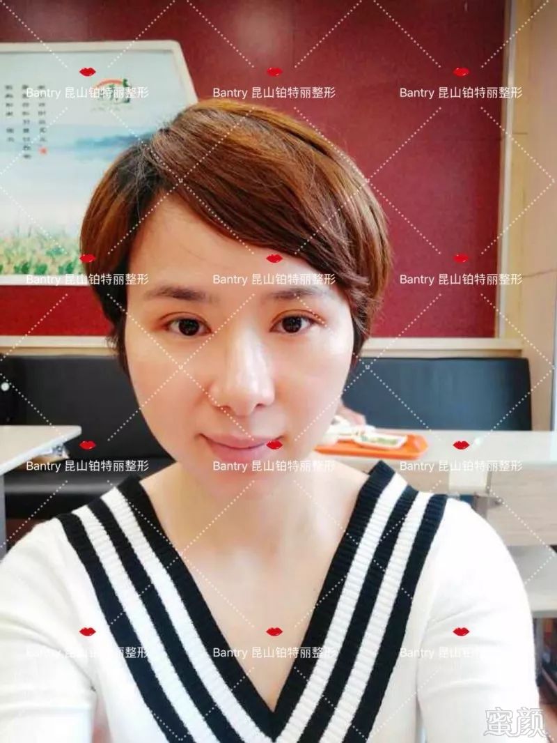 https://img.miyanlife.com/mnt/timg/180705/113ZH5U-15.jpg