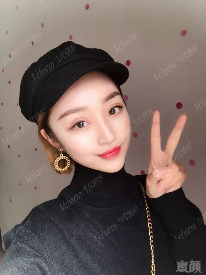 https://img.miyanlife.com/mnt/timg/180705/1142244951-9.jpg