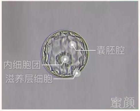 https://img.miyanlife.com/mnt/timg/180705/1204525S2-2.jpg
