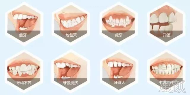 https://img.miyanlife.com/mnt/timg/180705/12232a148-10.jpg